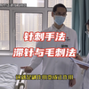 针刺手法 滞针与毛刺法