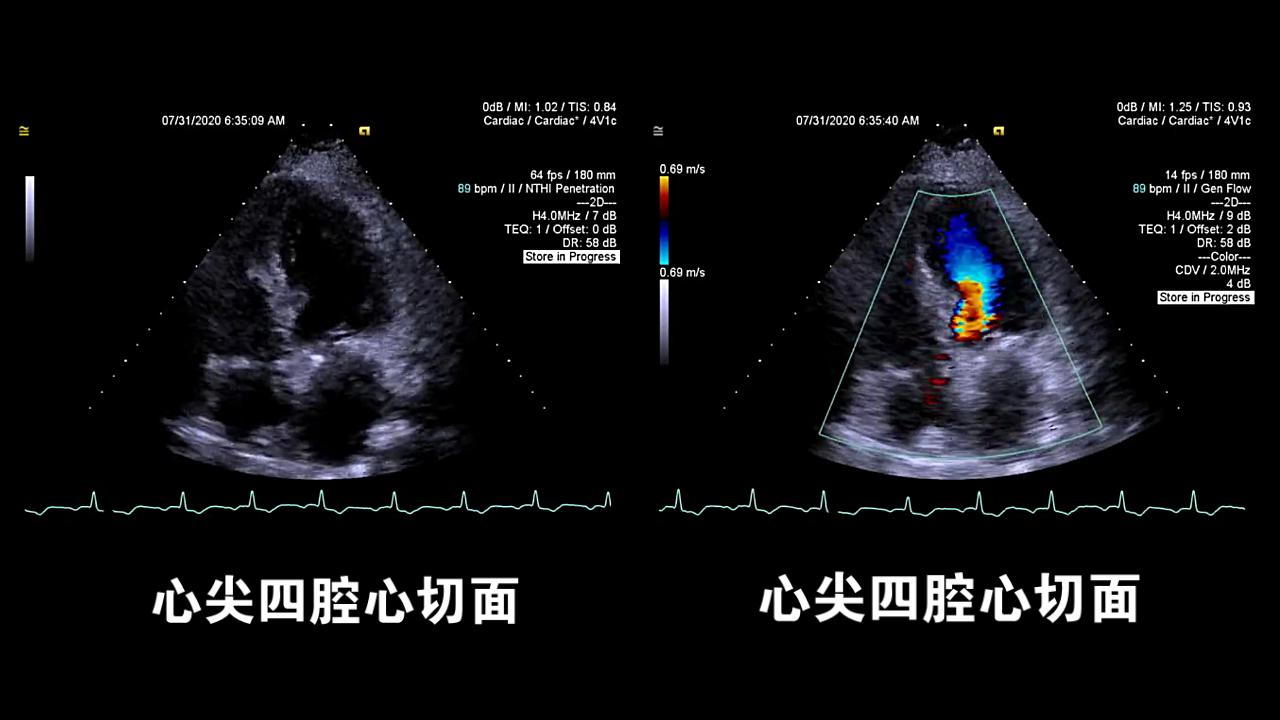 成片-2020-10-12 17:32:09