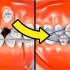 用动画展示牙套是如何矫正牙齿的，超神奇的牙套。