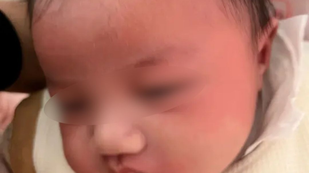 瓶装白酒 奶奶误当水给娃冲奶粉，妈妈晒出诊断证明：急性酒精中毒！妈妈：喝下去时间太久，医生说洗胃已经没用了，那时候已经是全看孩子的造化了