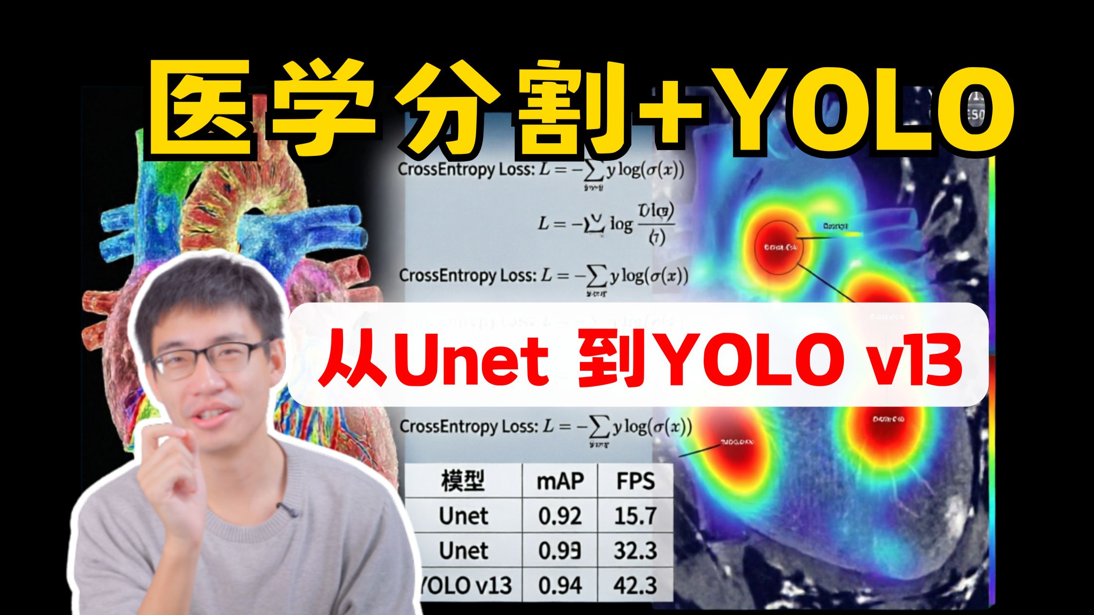 【CV实战项目】医学分割+YOLO v1-v13全系列拆解！从Unet到DeepLabV3+，学完轻松搞定毕业论文！
