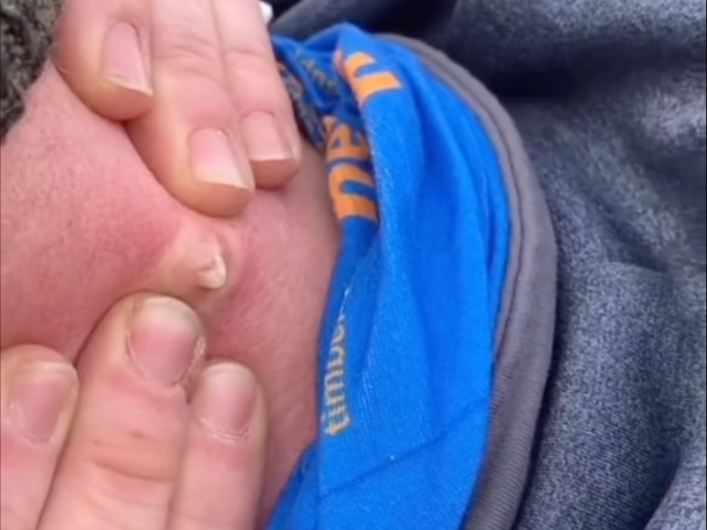 解压助眠！大黑头！