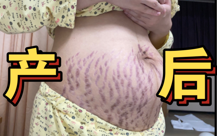 【产后日记】94年深圳女孩生完孩子后第20天的肚子…