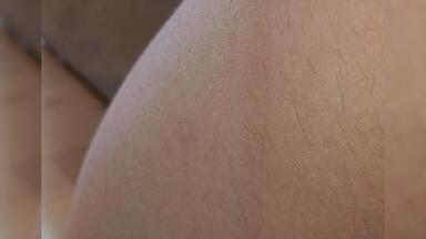 <em class="keyword">猴子捞月</em>被抽到腿了