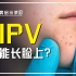 HPV还能长脸上？san值狂掉啊家人们
