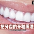 洗牙会把牙齿的牙釉质洗掉吗？