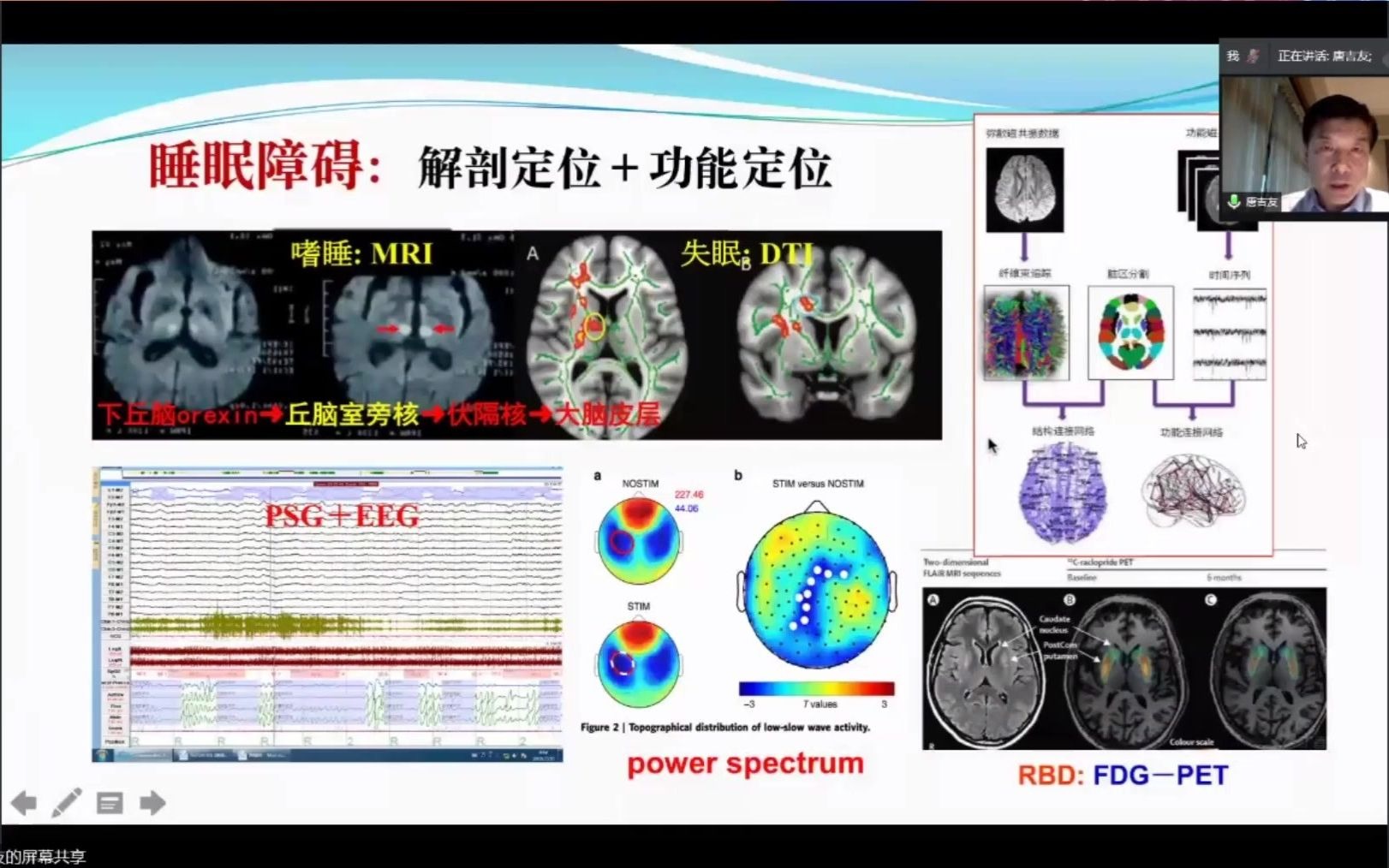 睡眠障碍的评估及诊断流程 唐吉友 哔哩哔哩 つロ干杯 Bilibili