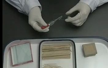 1 粪便生理盐水直接涂片法