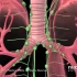 【3D演示】肺癌（原版+字幕版）