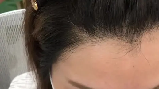 女生美人尖能有多美！