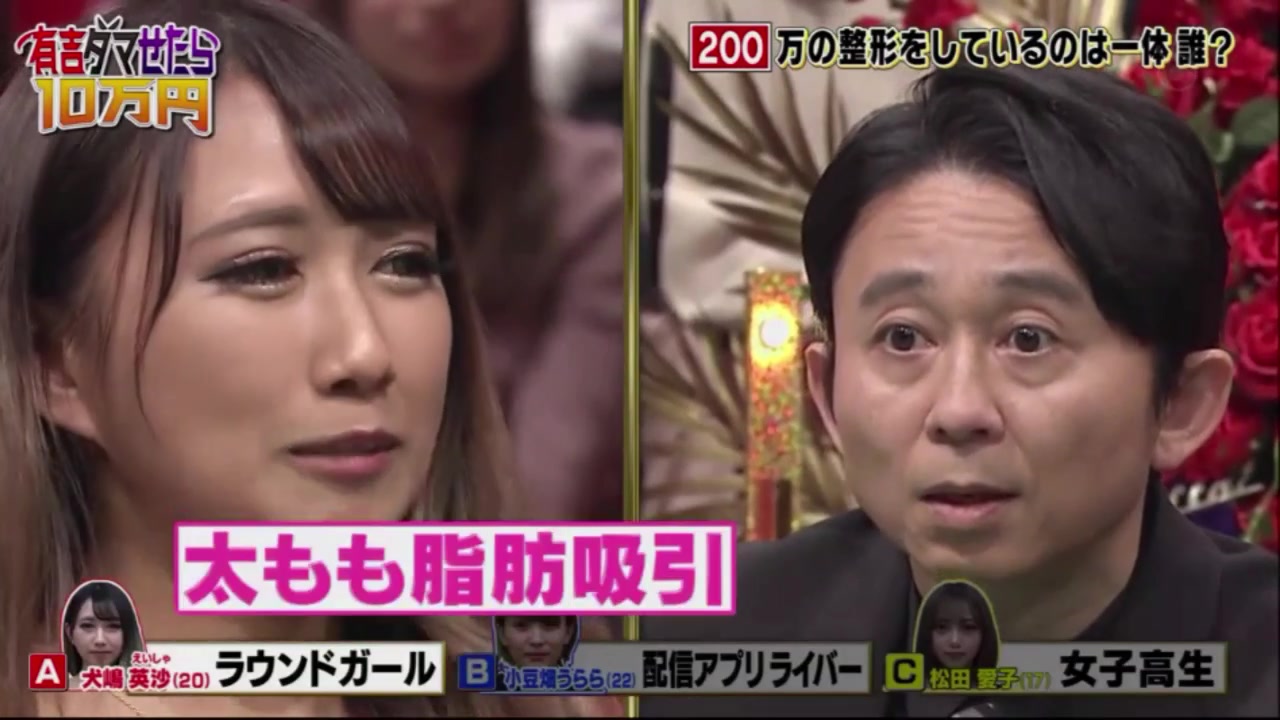 整形 松本 伊代