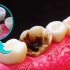 怎么处理缺了一大半的牙齿，这个视频能告诉你答案