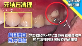 857b8e52aab5d50bfd929aa2f614e31080ee219a.jpg@280w_158h_1c_100q.jpg