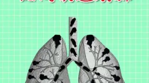 长期吸烟的人如何快速清肺