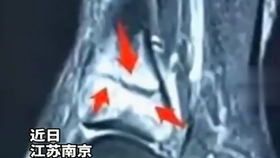 8a1d8574b8dc4d76c2968f6e40f49446ac19d533.jpg@280w_158h_1c_100q.jpg
