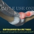 【3D医学动画】一名患者得了腱鞘炎，这是他手指发生的变化