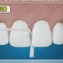 济宁壹颗芽口腔：为什么要选择用牙线清洁牙齿呢？