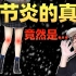 光腿警告！中国6000万人患骨关节炎，不穿秋裤到底有没有问题？“老寒腿”的成因居然是这样