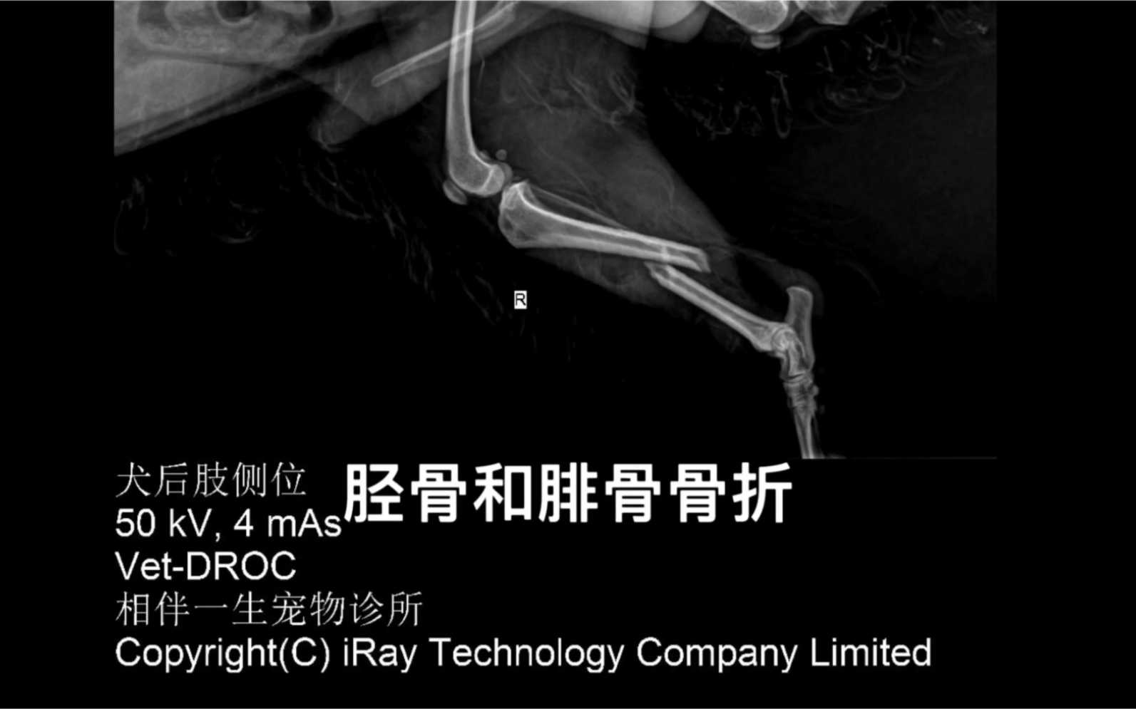 坚强的狗子 胫骨和腓骨骨折 哔哩哔哩 つロ干杯 Bilibili