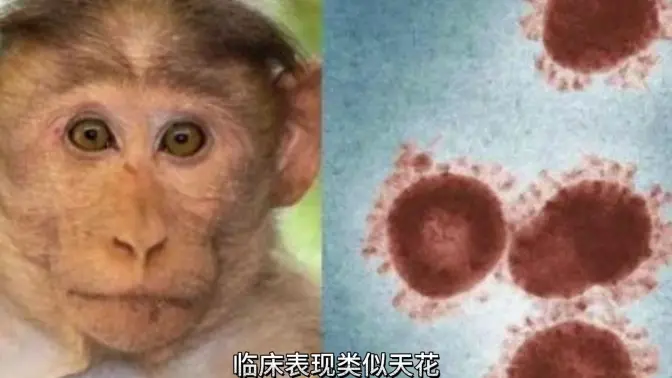 最近出现的猴痘，你知道是什么吗？