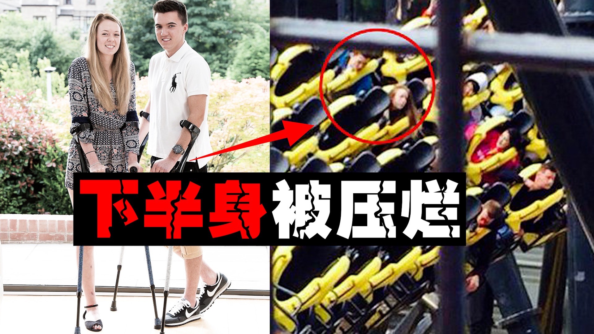 【截肢过山车】一个失误好友集体截肢，用“断腿”宣传结果一语成谶。。。