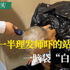 头剃一半理发师吓的站起来：一脑袋“白虫”！#白癜风# #白斑