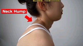 怎么变瘦消除法令纹 926419d74f878acdb4b15e913620319edc0c5623.jpg@280w_158h_1c_100q.jpg
