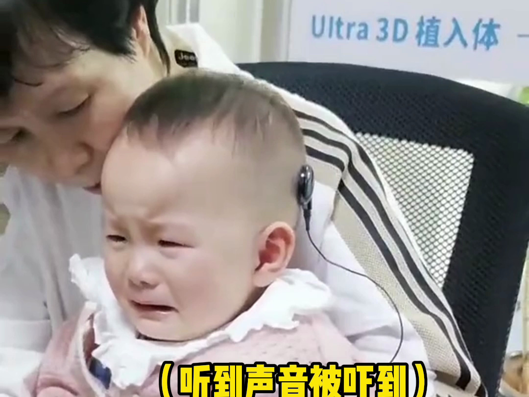 17个月大宝宝植入人工耳蜗，听见声音的瞬间被吓哭，“宝宝哭了，妈妈也哭了”