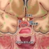 人体最复杂的内分泌腺，垂体瘤的发生过程，3D演示。。