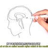呕吐生理-呕吐反射 | Physiology of Vomiting - Vomiting reflex | Armando