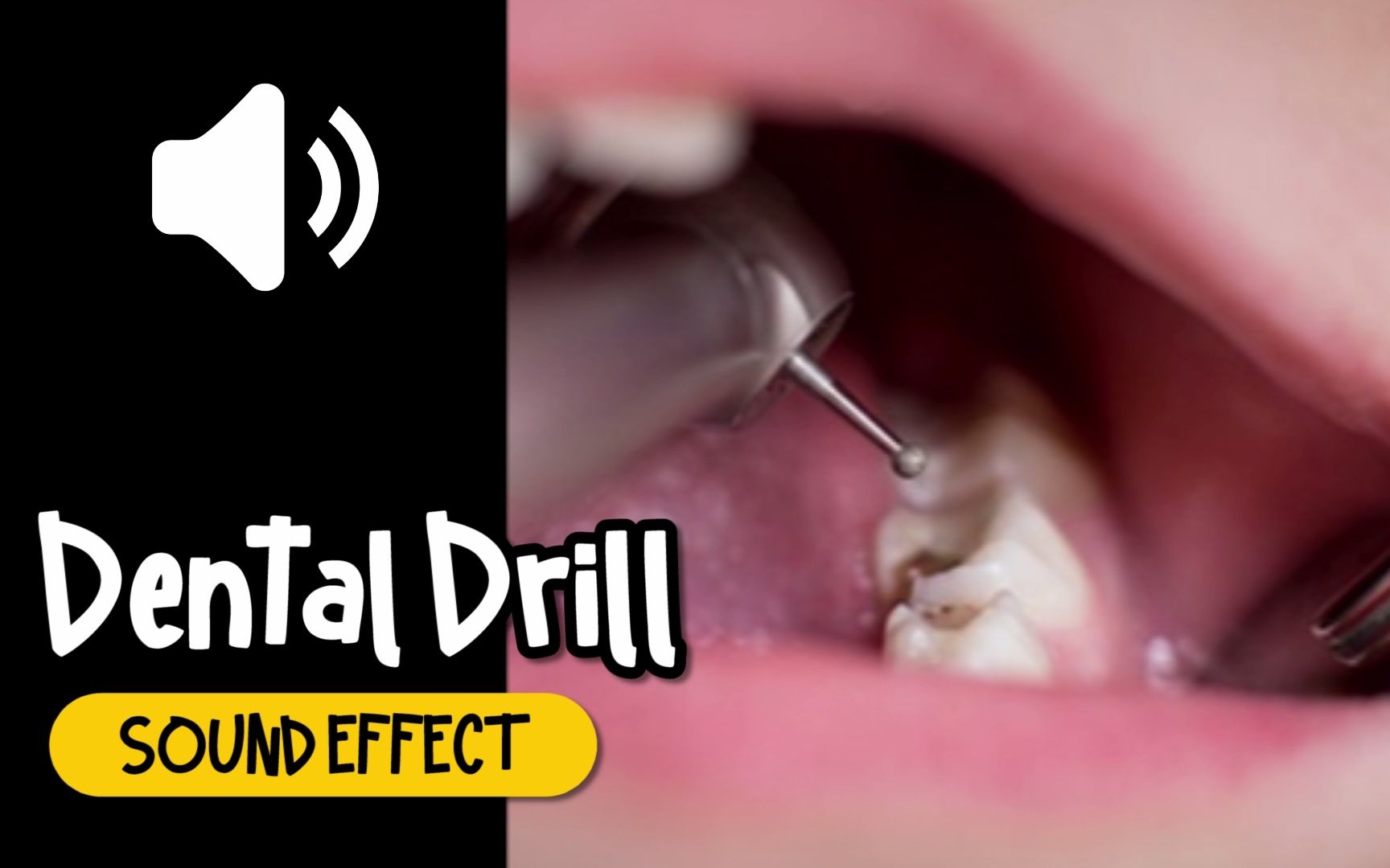 牙医 牙科 牙钻 仪器 音效 (HQ)