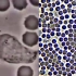 微观战场：巨噬细胞在血液中追杀细菌