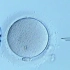 ICSI卵胞浆内单精子显微注射技术
