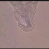 扁形动物门——三代虫生殖过程