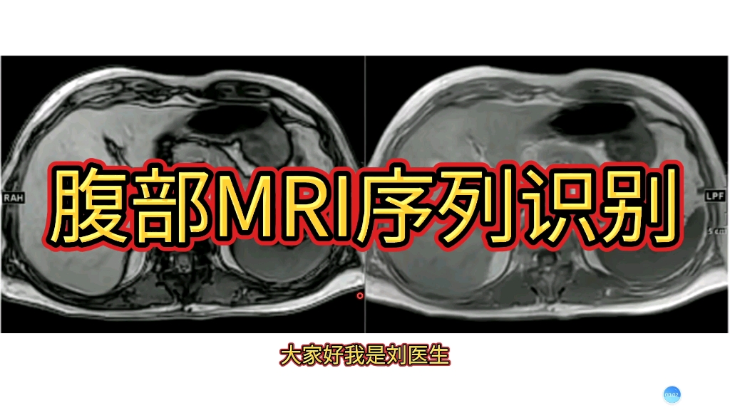 MRI入门：腹部MRIT1、T2序列识别，简单易懂！