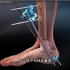 骨科手术就是木匠活，胫骨下端骨折外部固定手术过程，3D演示。。