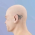 人工耳蜗安装手术过程，3D演示。。