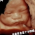 杭州玛莉亚妇产：胎儿在妈妈肚子里可以有多萌