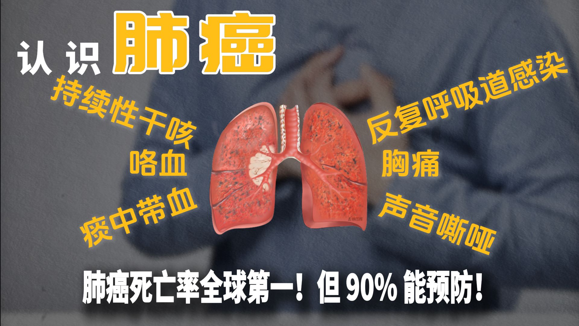 【癌症系列】肺癌死亡率全球第一！但 90% 能预防！戒烟 + 避油烟 + 筛查，3 步保命，快转给爸妈！