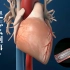 不用开刀就能完成的“心脏支架”手术，是怎么完成的？