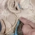 颈丛神经的解剖标本讲解