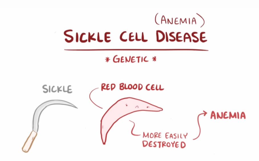 搬运osmosissicklecellanemia