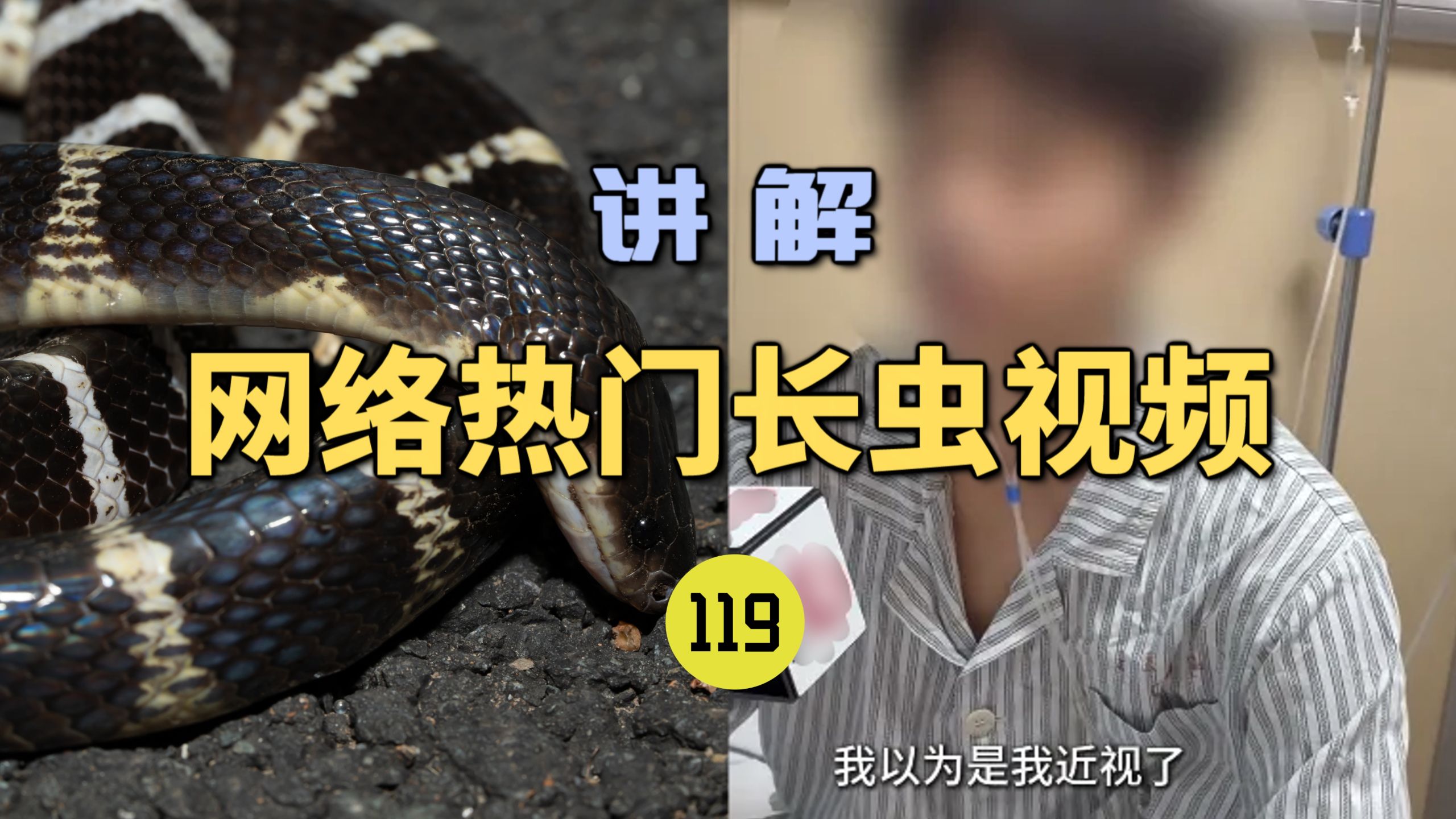网络热门长虫视频(119)广州一男生被银环蛇咬伤后淡定上课！看黑板模糊还以为是近视了？