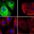 细胞生物-细胞自噬诱导及自噬小体荧光观察 （荧光蛋白标记技术）