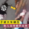妹子被大车碾压，胎儿当场被挤出来了，太惋惜了