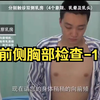 全身体格检查 前侧胸部检查