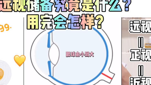 散光是怎么样造成的,散光是怎么样的感觉