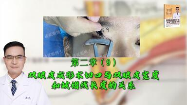 为什么切口位置高/低，术后<em class="keyword">双眼皮</em>还是显窄/宽？第二章（9)：<em class="keyword">双眼皮</em>成形术切口与<em class="keyword">双眼皮</em>宽度和皱褶线长度的关系。潘贰 主编 《<em class="keyword">双眼皮</em>成形术及“失败”<em class="keyword">修复</em>全攻略》