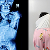 新疆12岁小女孩，先天性脊柱侧弯，后背隆起大包