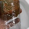 扩肛